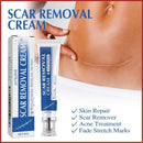 Crema para Eliminar Cicatrices 30GR JAYSUING – Regeneración y Mejora Visible de la Piel